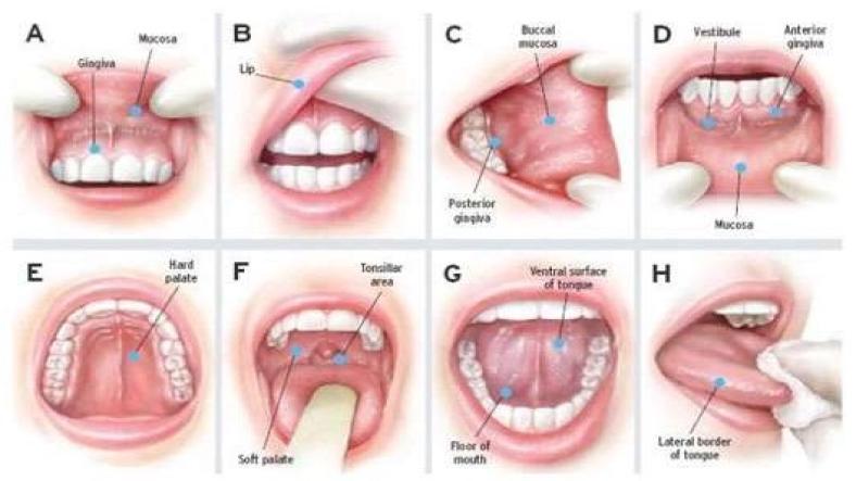 Benefits of Regular Oral Cancer Screenings