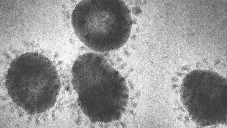 Coronavirus, Discovered in the 1960s, Serious Respiratory Tract Infections Coronavirus, Discovered in the 1960s, Serious Respiratory Tract Infections