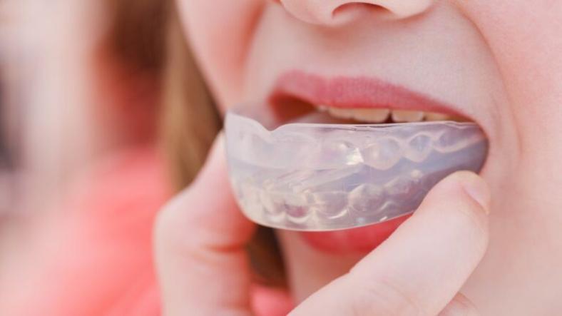 How to Choose the Right Mouthguard