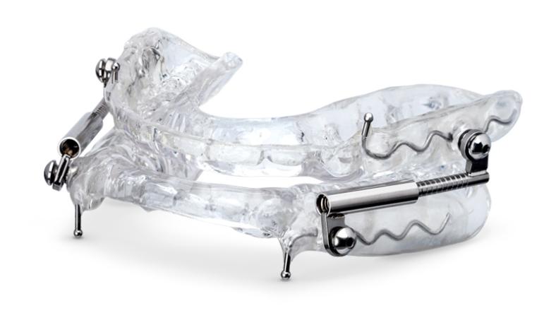 The Benefits of Custom-Fitted Dental Appliances