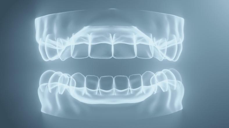 The Benefits of Regular Dental X-Rays