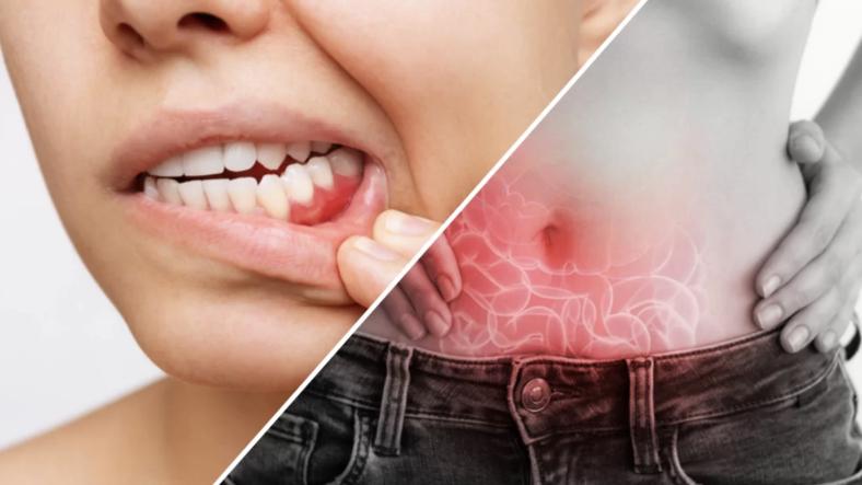 The Connection Between Oral Health and Digestive Health The Connection Between Oral Health and Digestive Health