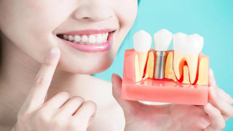 Understanding the Benefits of Dental Implants